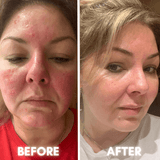 SC7 Mattifying Sebum Control Cream - KEAPURE